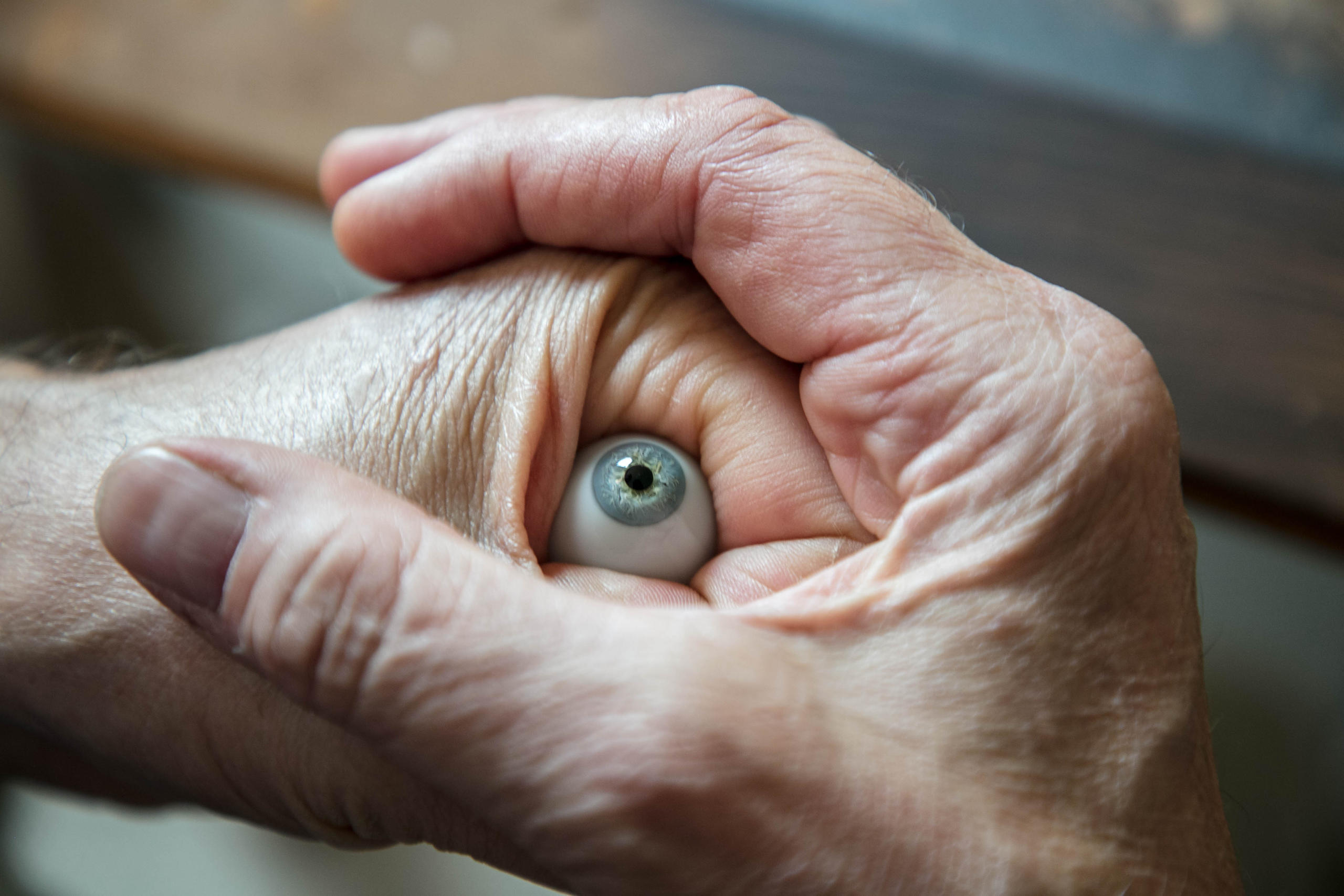Matthias Buckel envolve um olho terminado com as duas mãos
