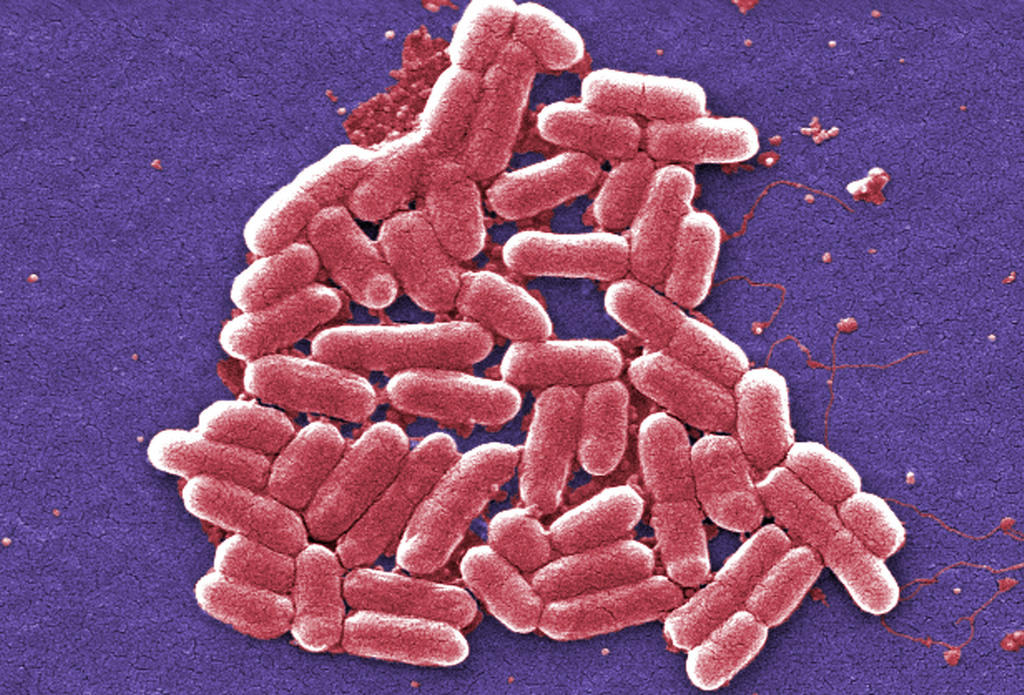 A colorised scanning electron micrograph image of E. coli bacteria.