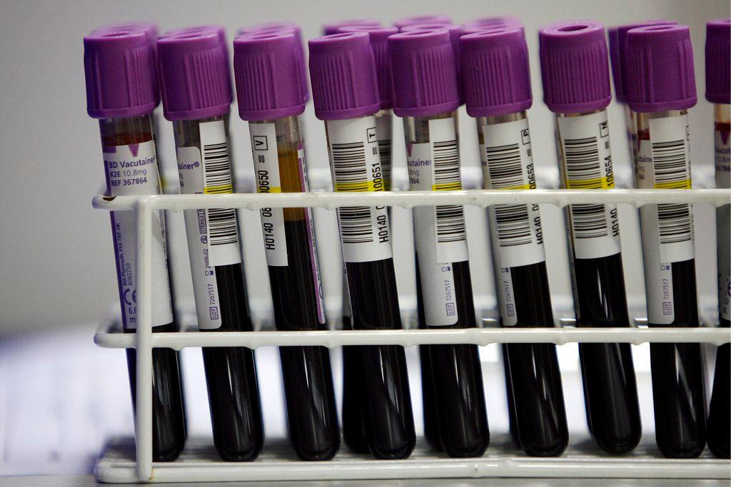 Blood samples in a rack