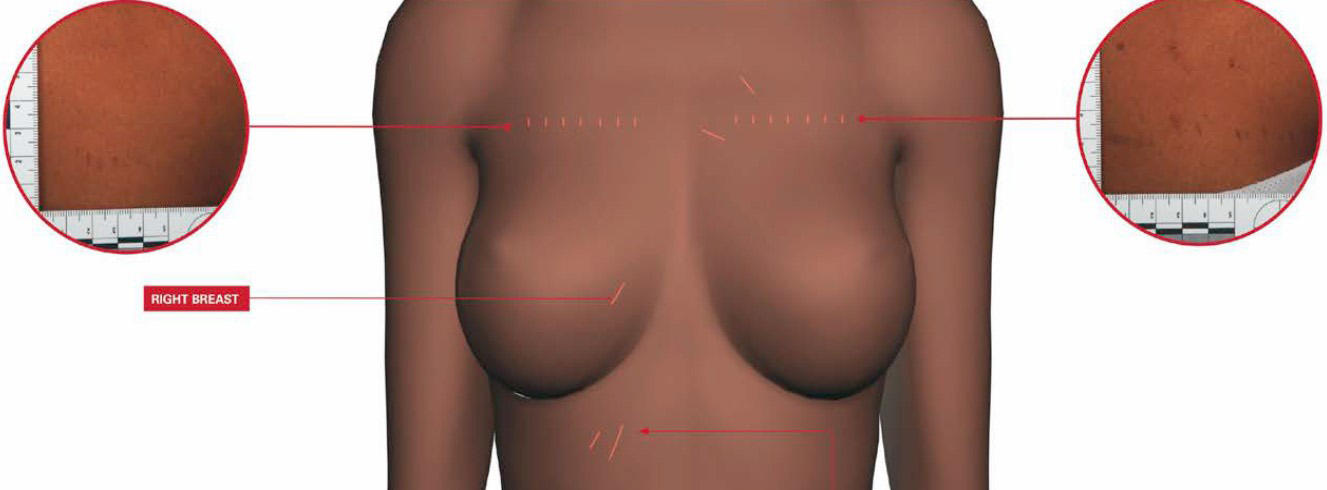 gráfico del busto de una víctima del ritual vudú yuyu