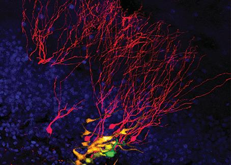 Microscopic image of neural stem cell and daughter neurons in a mouse brain