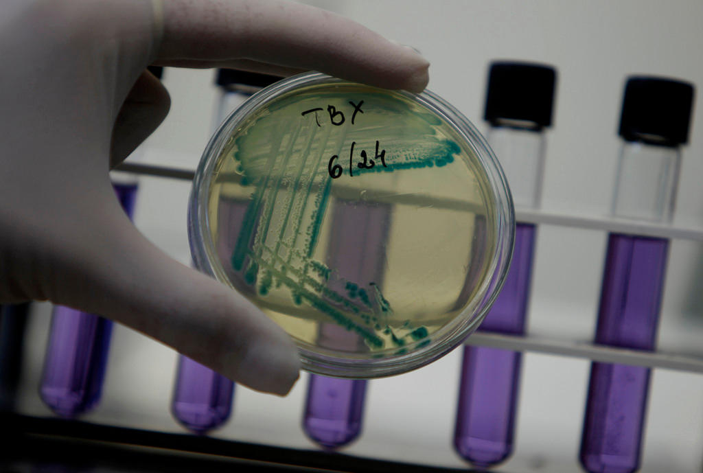 Lab technician holding slide of E.coli bacteria