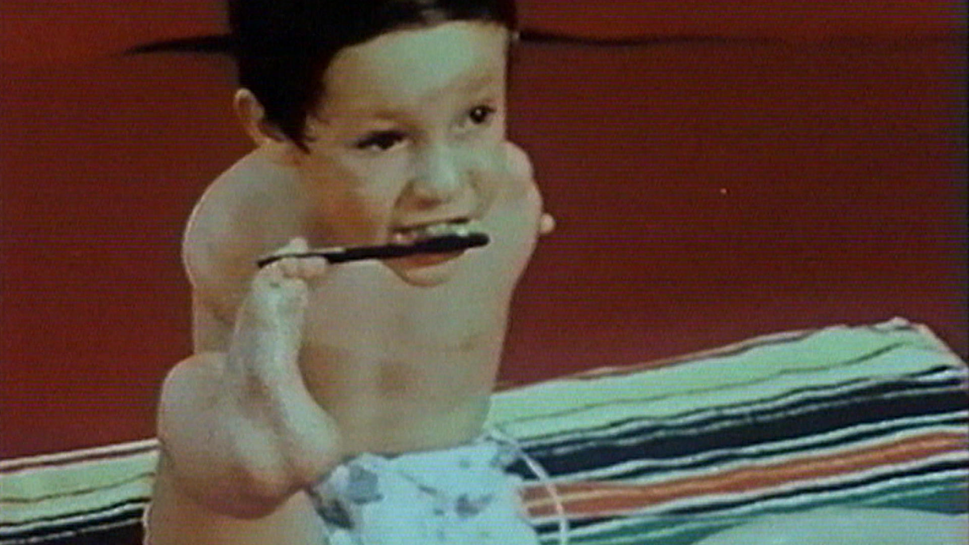 Child with a malformation brushing his teeth with his foot.