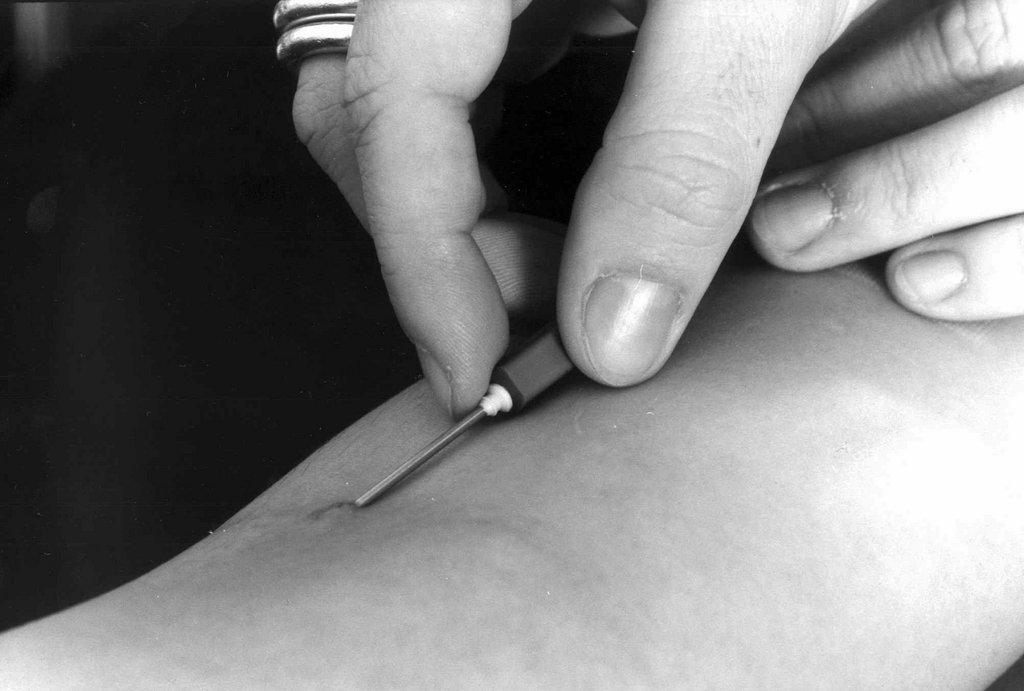 needle being pushed into arm