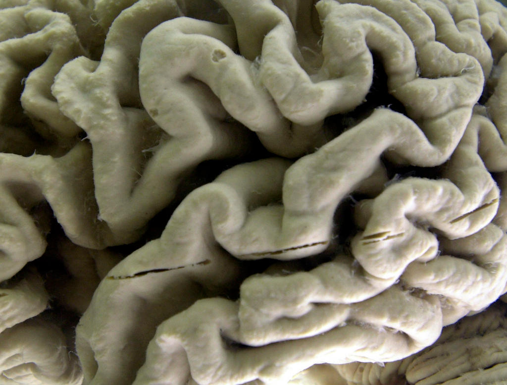 Close up of a human brain