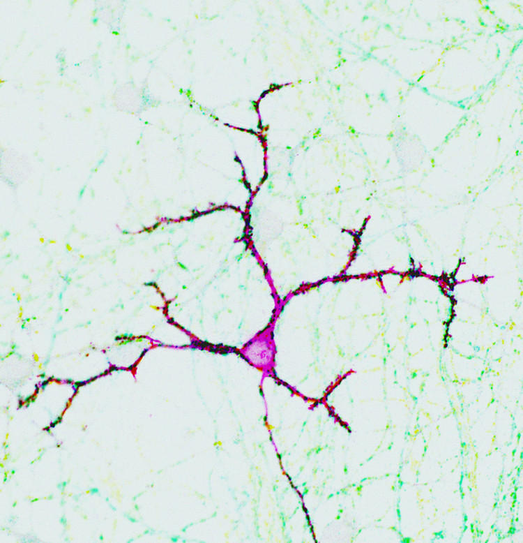 Neuron with synaptic contacts.