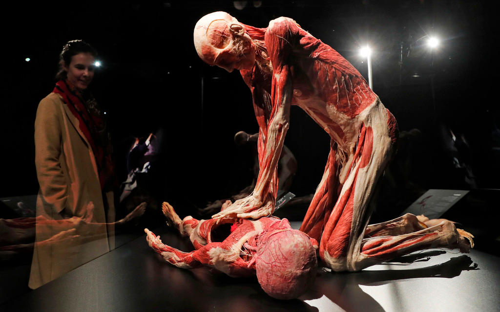 plastinated bodies