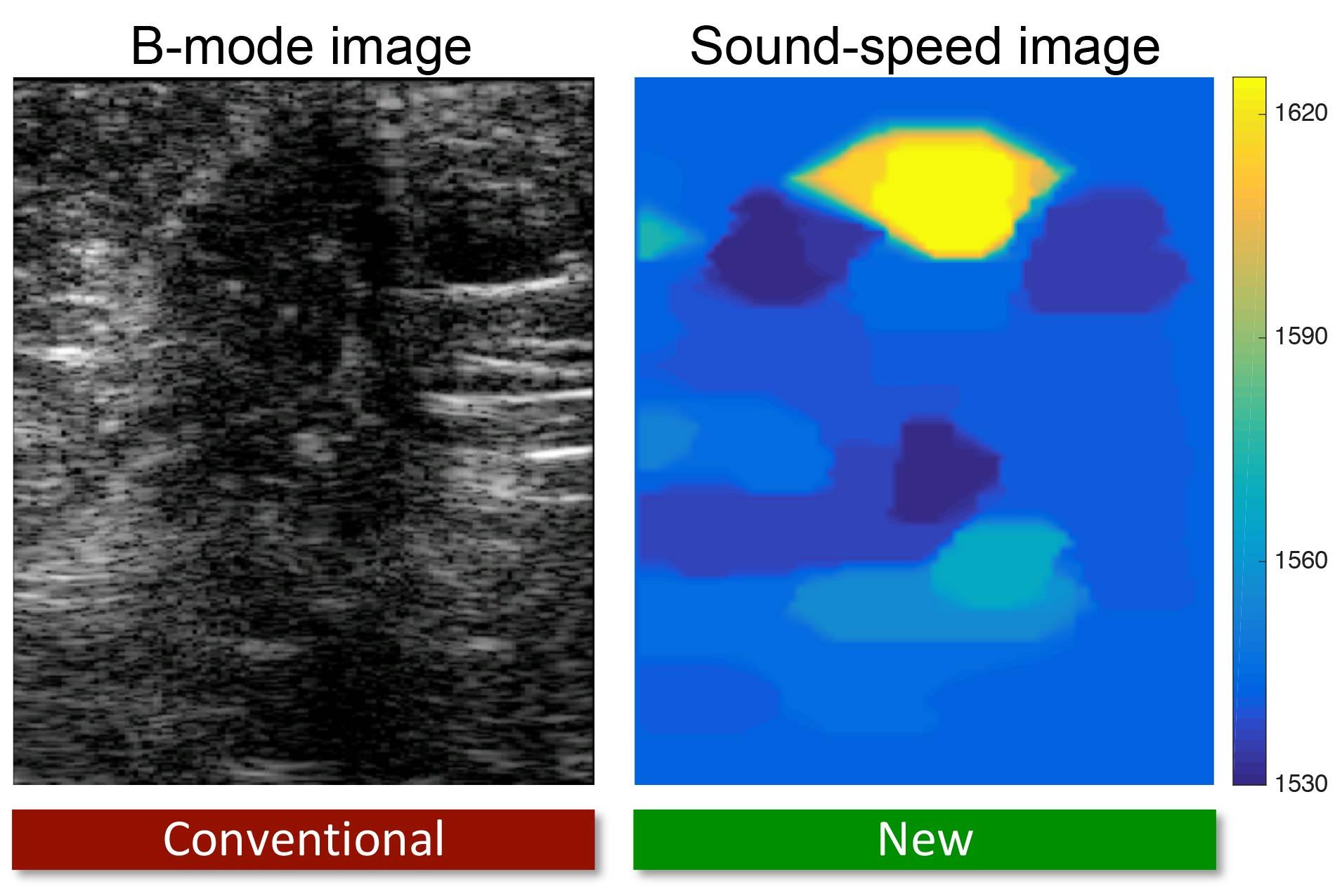 Imágenes de ultrasonidos