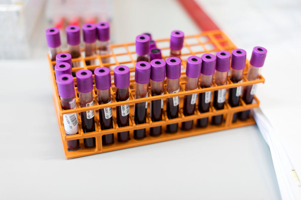 Diverse provette di sangue pronte per essere analizzate. Sangue raccolto durante una campagna di sensibilizzazione
