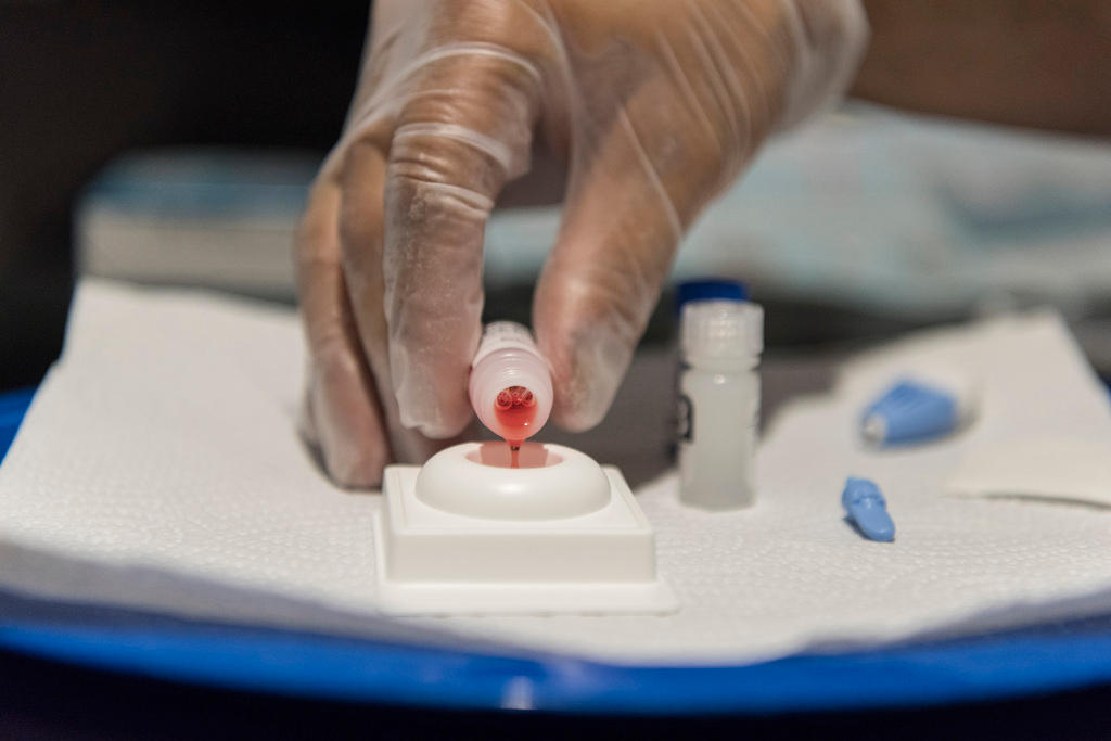 HIV self-test kit