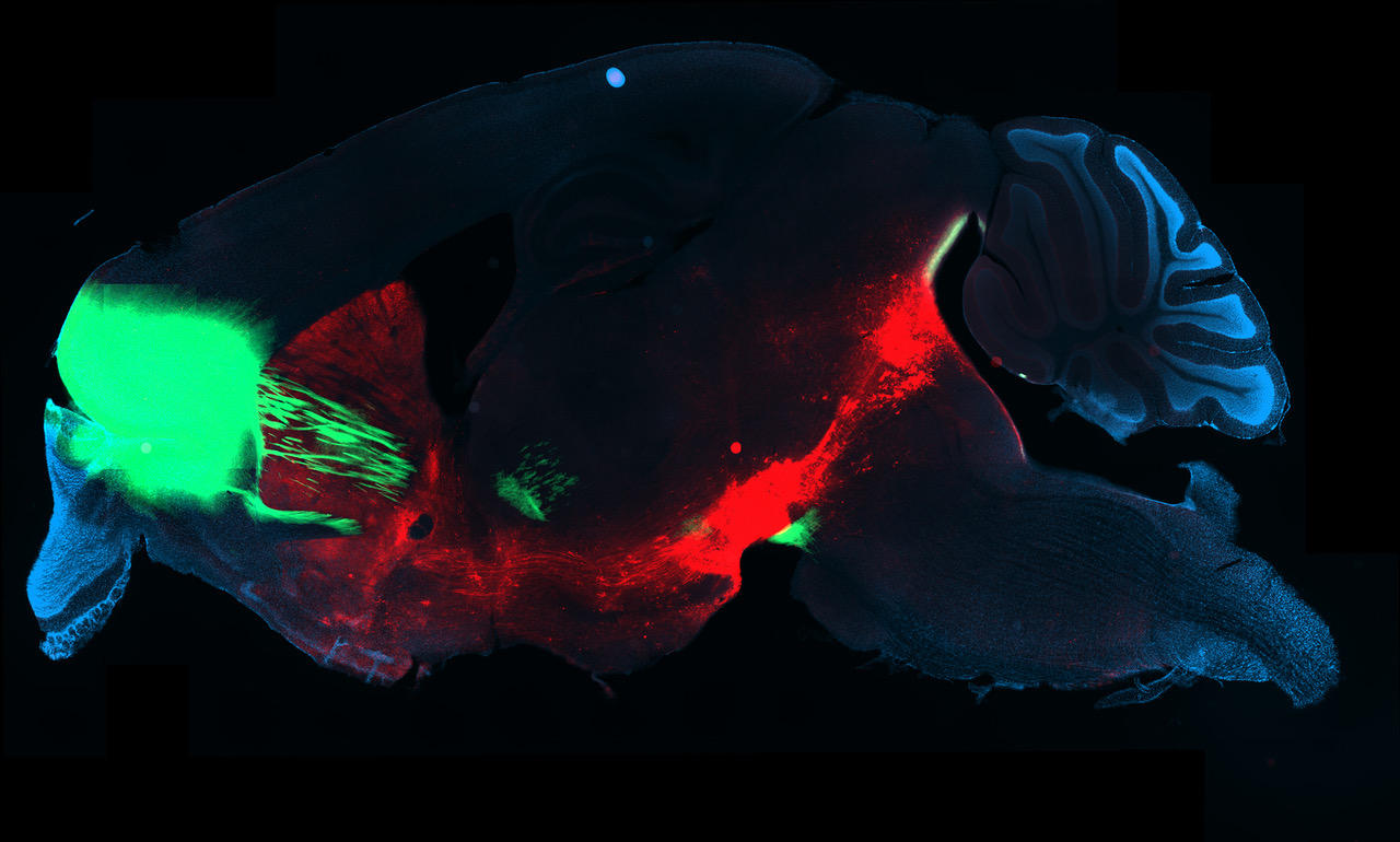 Mouse brain section