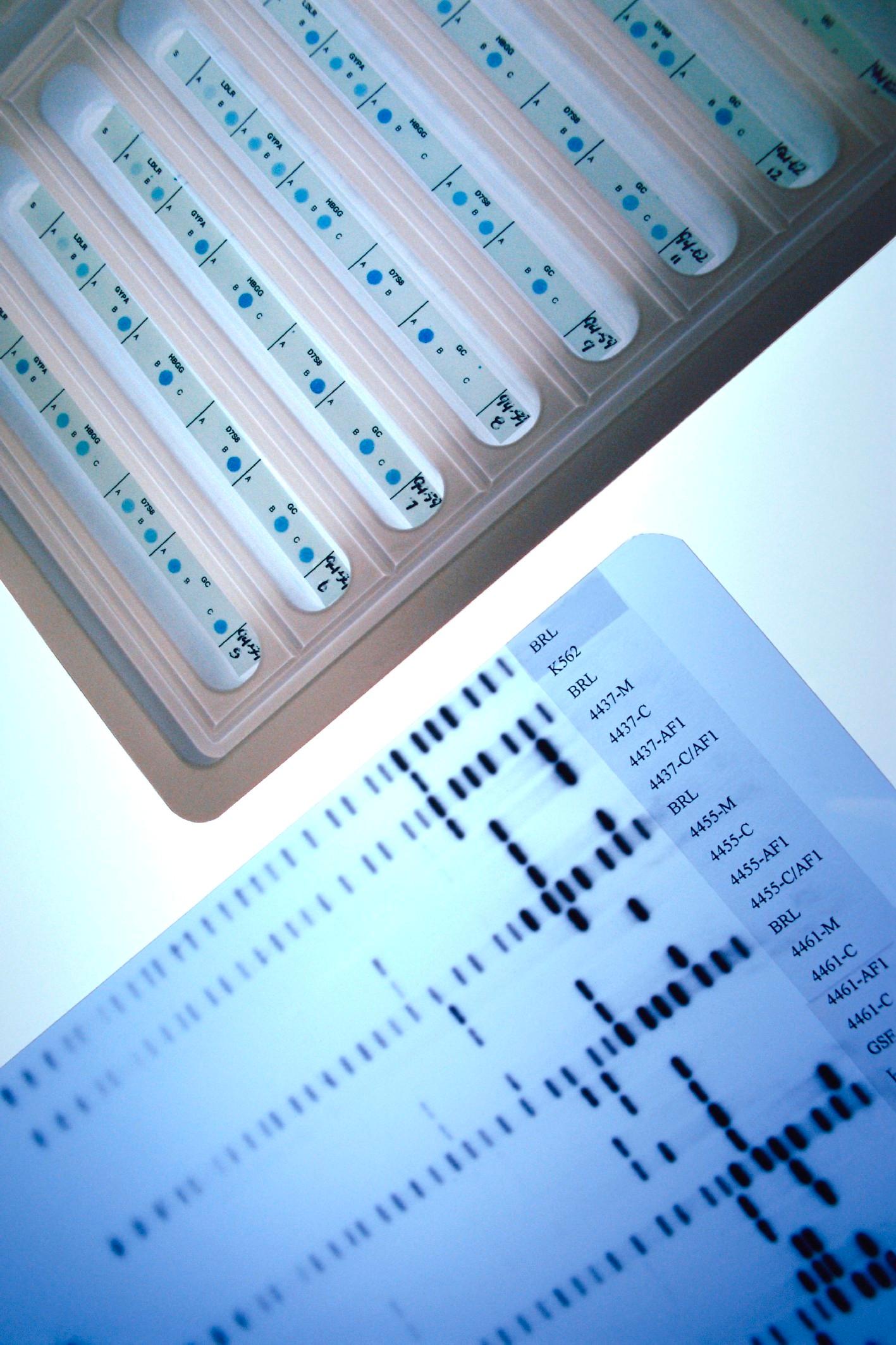 Early recognition of rheumatoid arthritis using biomarkers