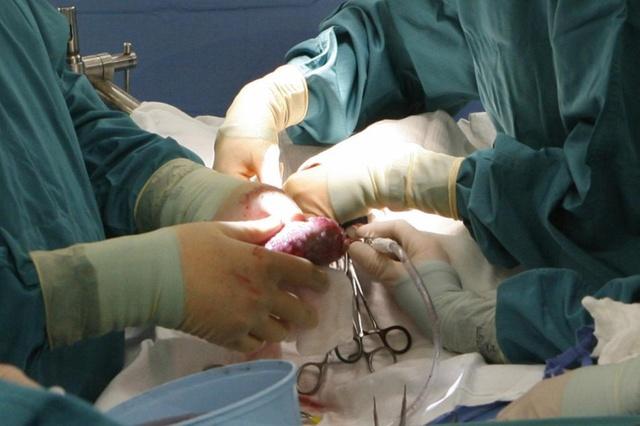 手术室摘器官