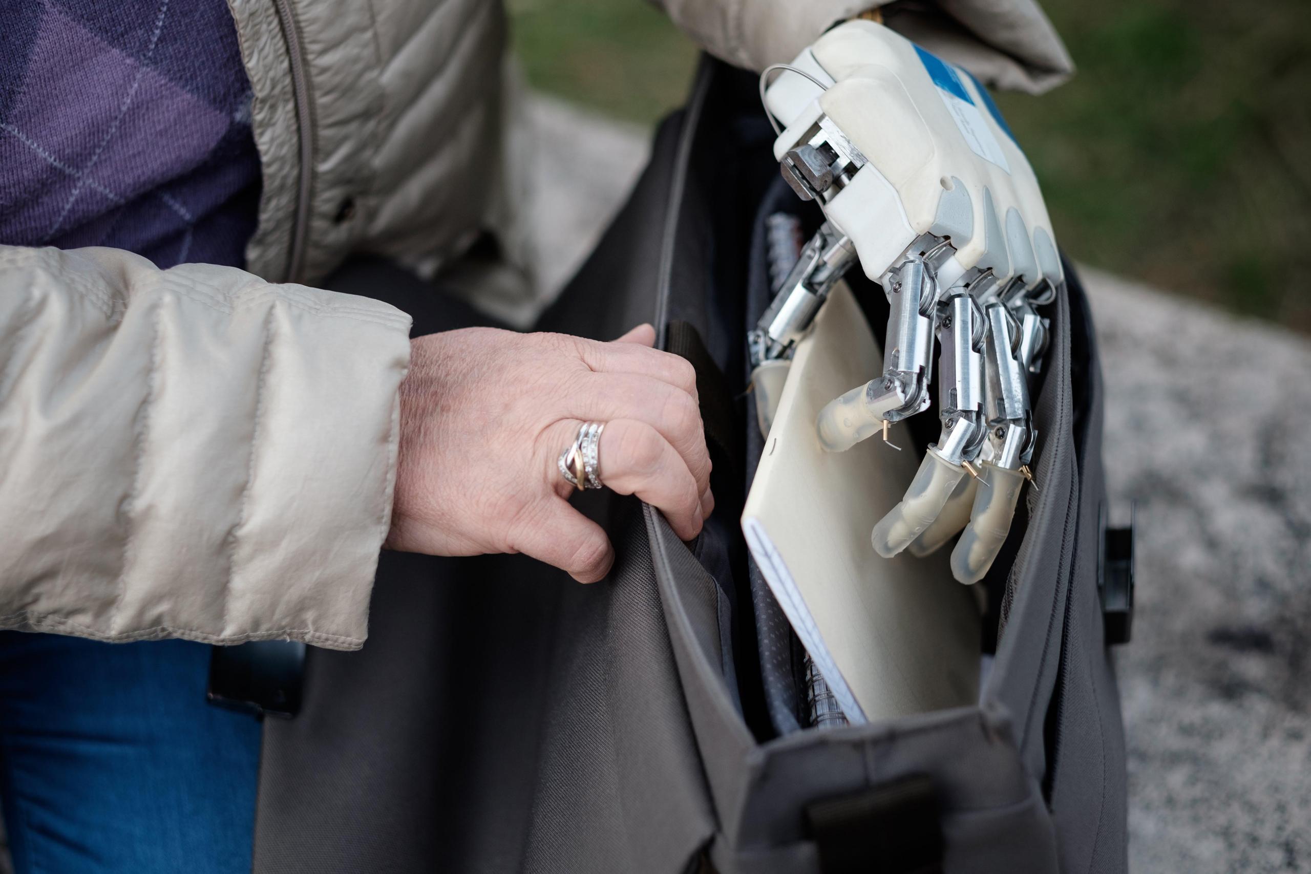 Prosthetic hand opening a purse