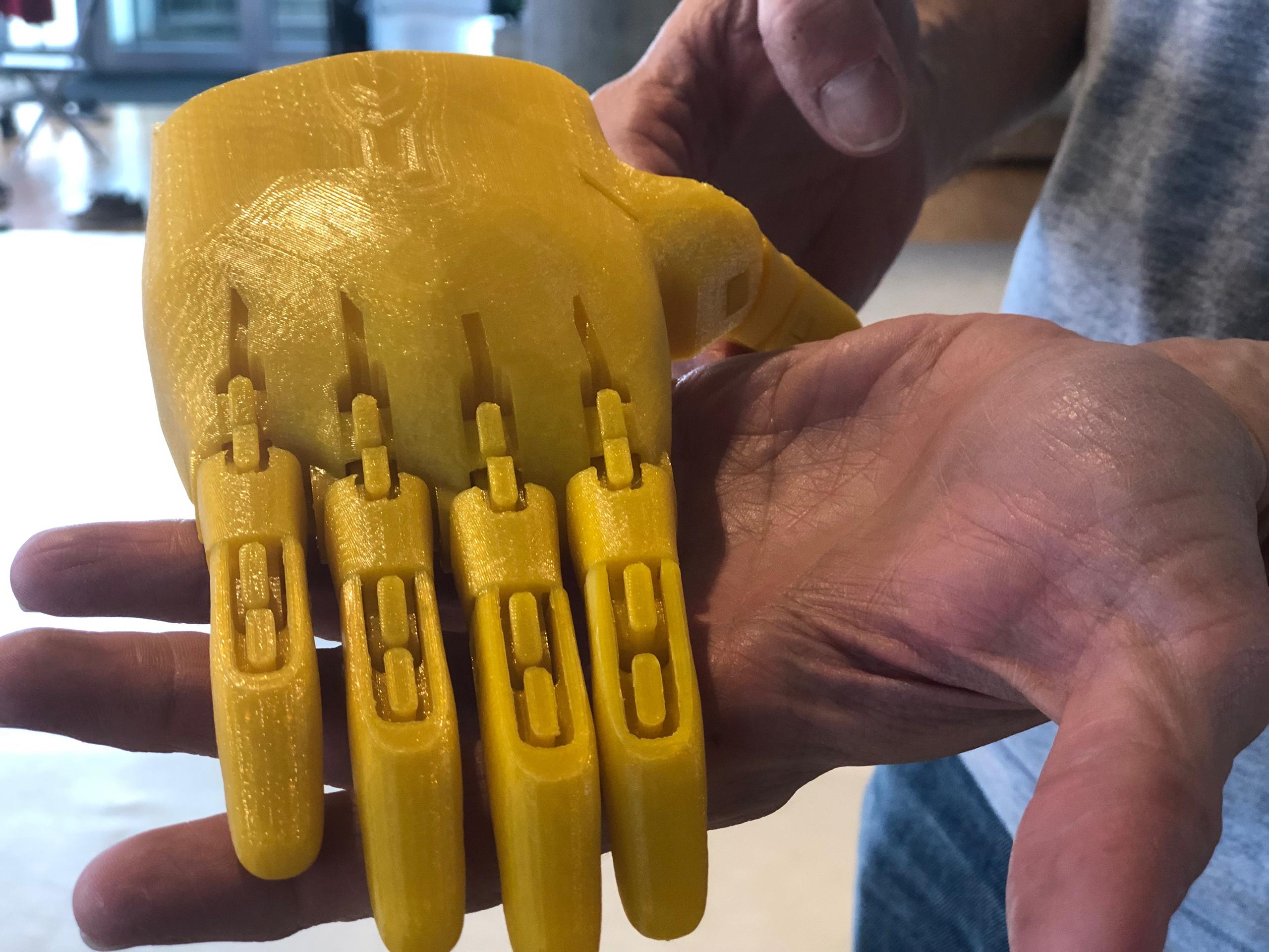 3D printed prosthetic hand