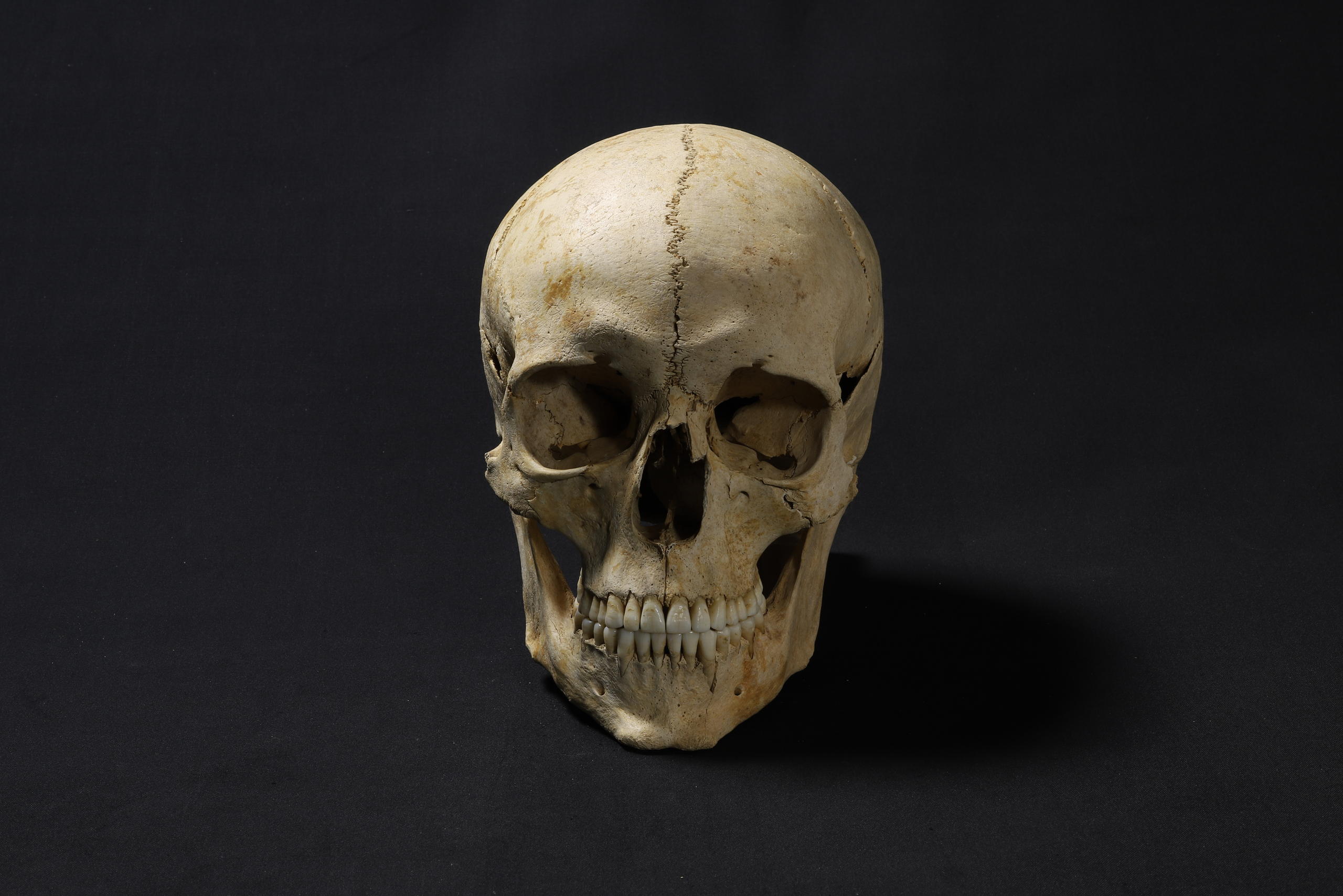 Skull of Adelasius Ebalchus
