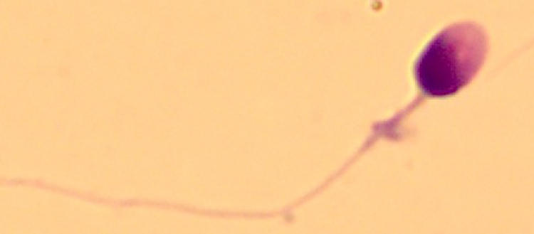 Spermatozoo