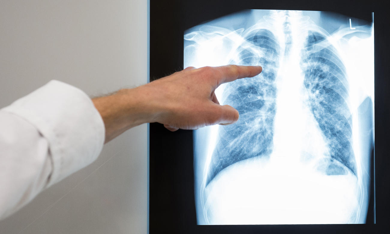 Doctor shows lungs