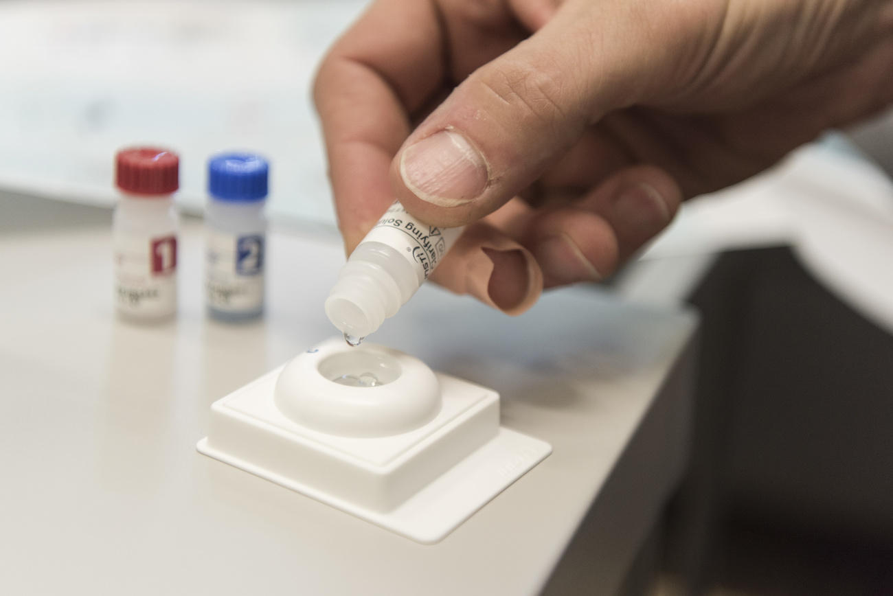 A man carries out an HIV self-test in Zurich