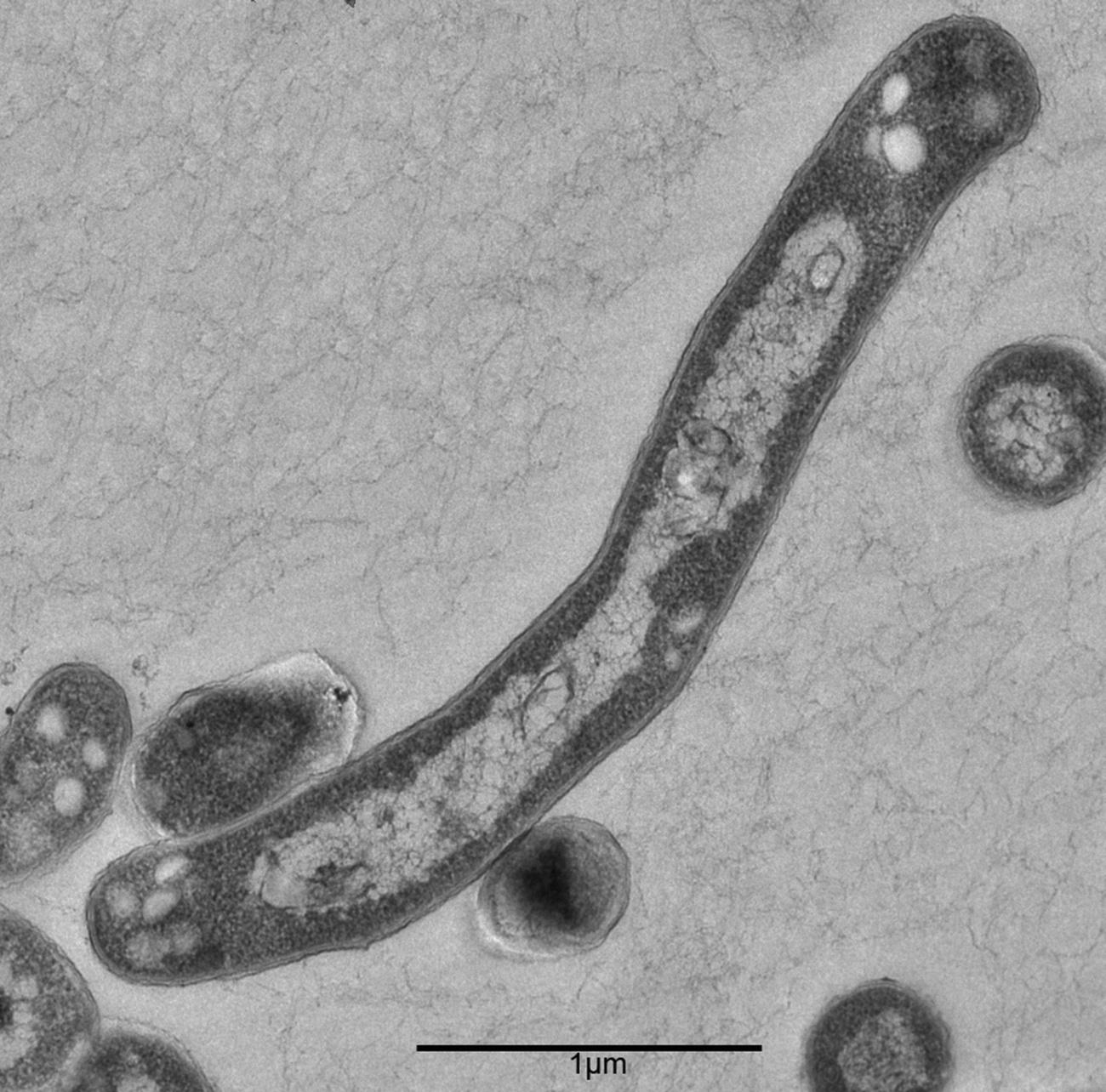TB bacteria