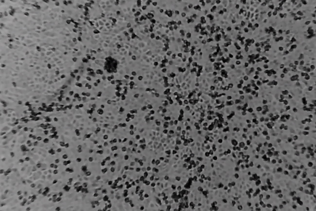 coronavirus image