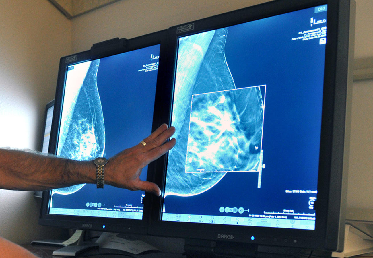 radiography