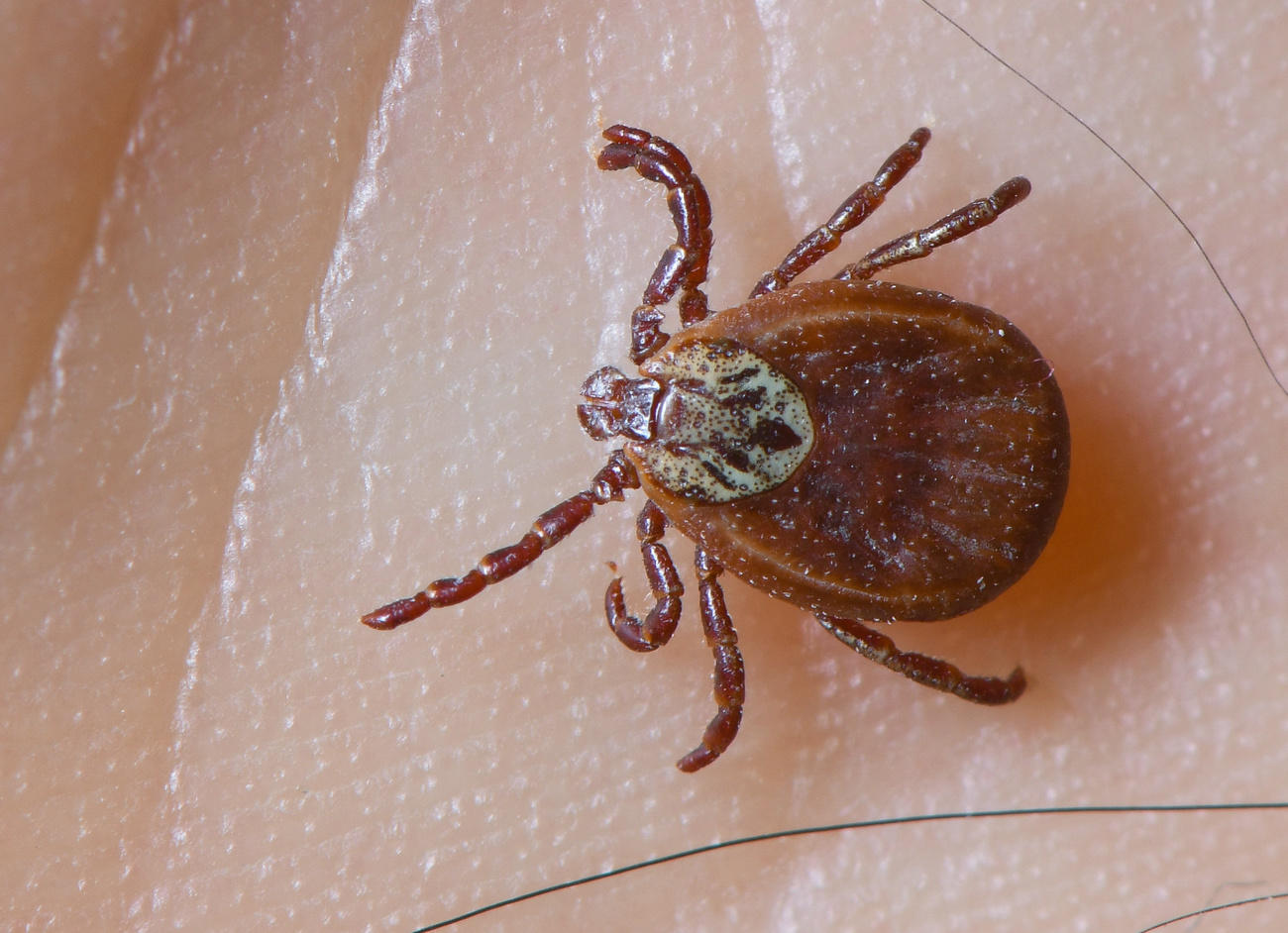 新冠疫情影响之下,人们行动习惯的改变可能会引起在城市附近休闲地区蜱虱叮咬事故的增加