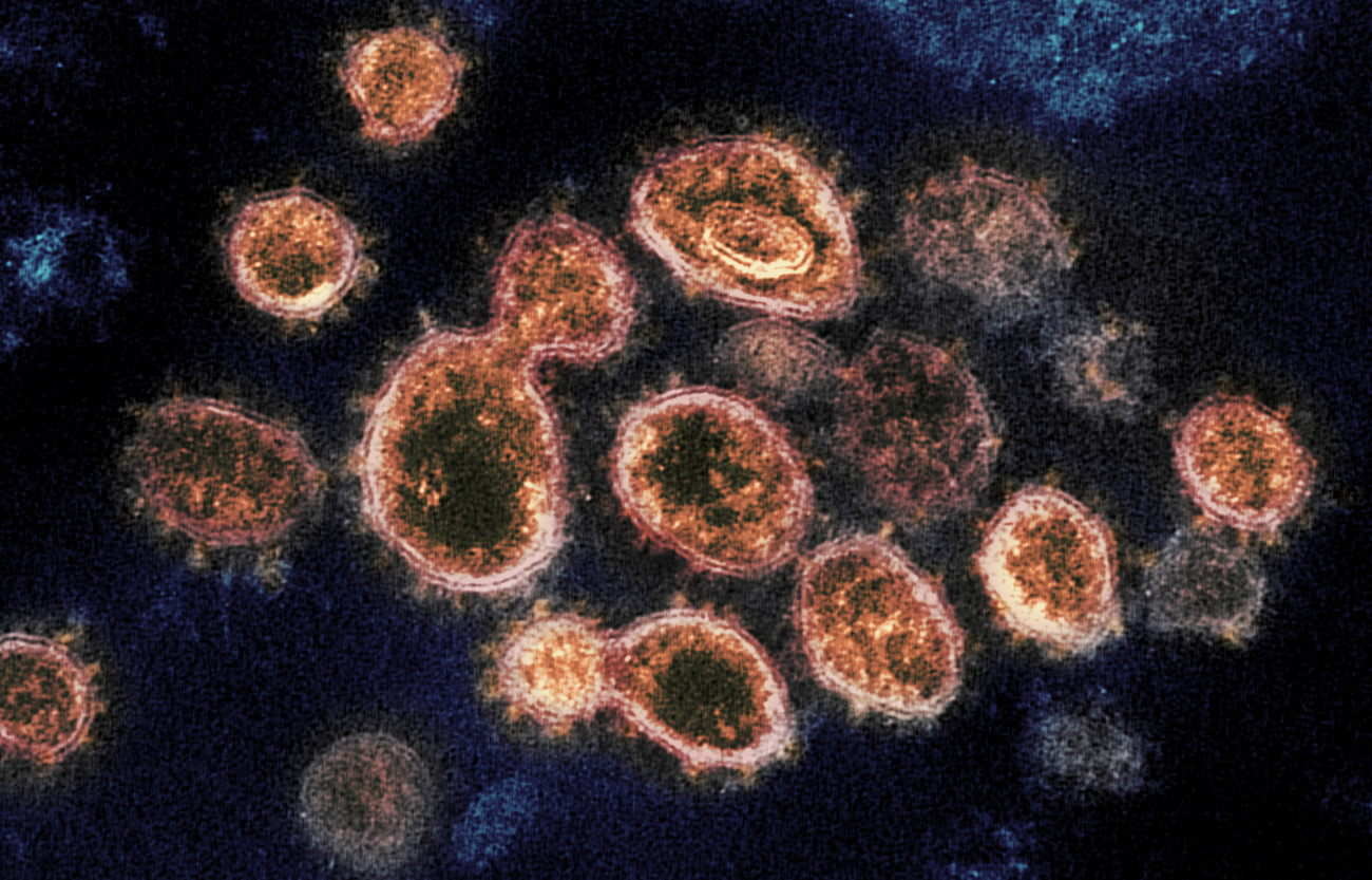 Coronavirus al microscopio