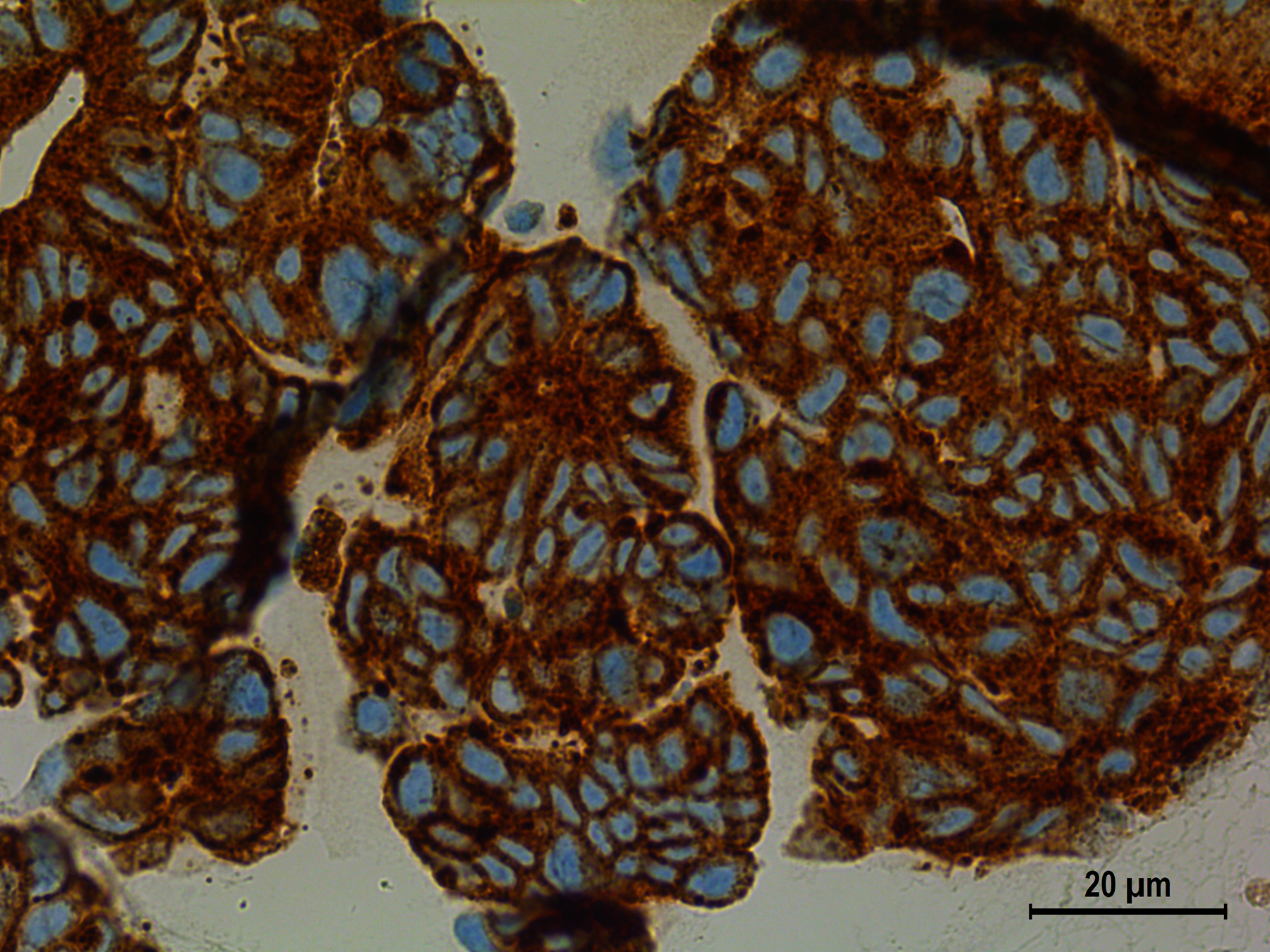 cancer cells