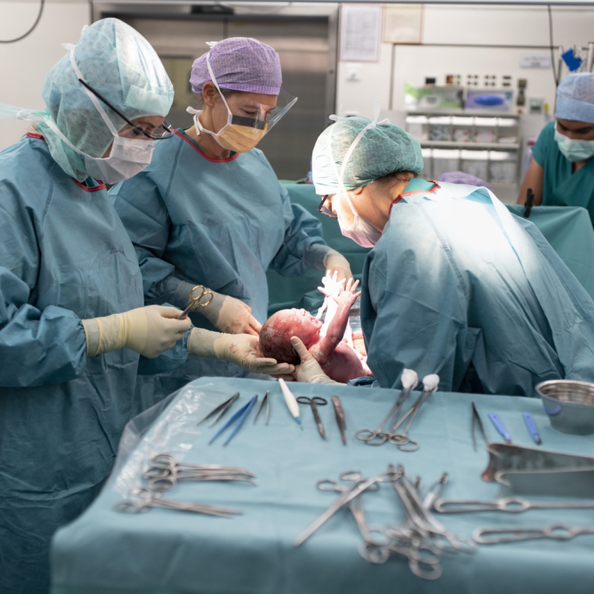 瑞士研究表明：剖腹產不能保證產後的性生活品質- SWI swissinfo.ch