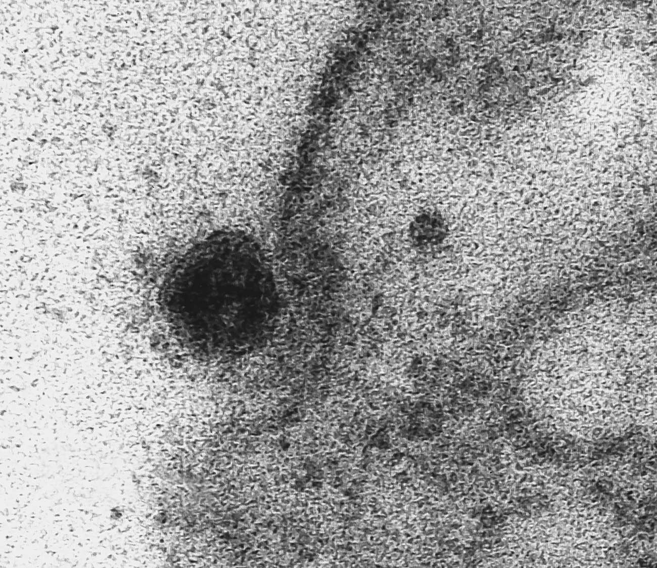 Coronavirus al microscopio