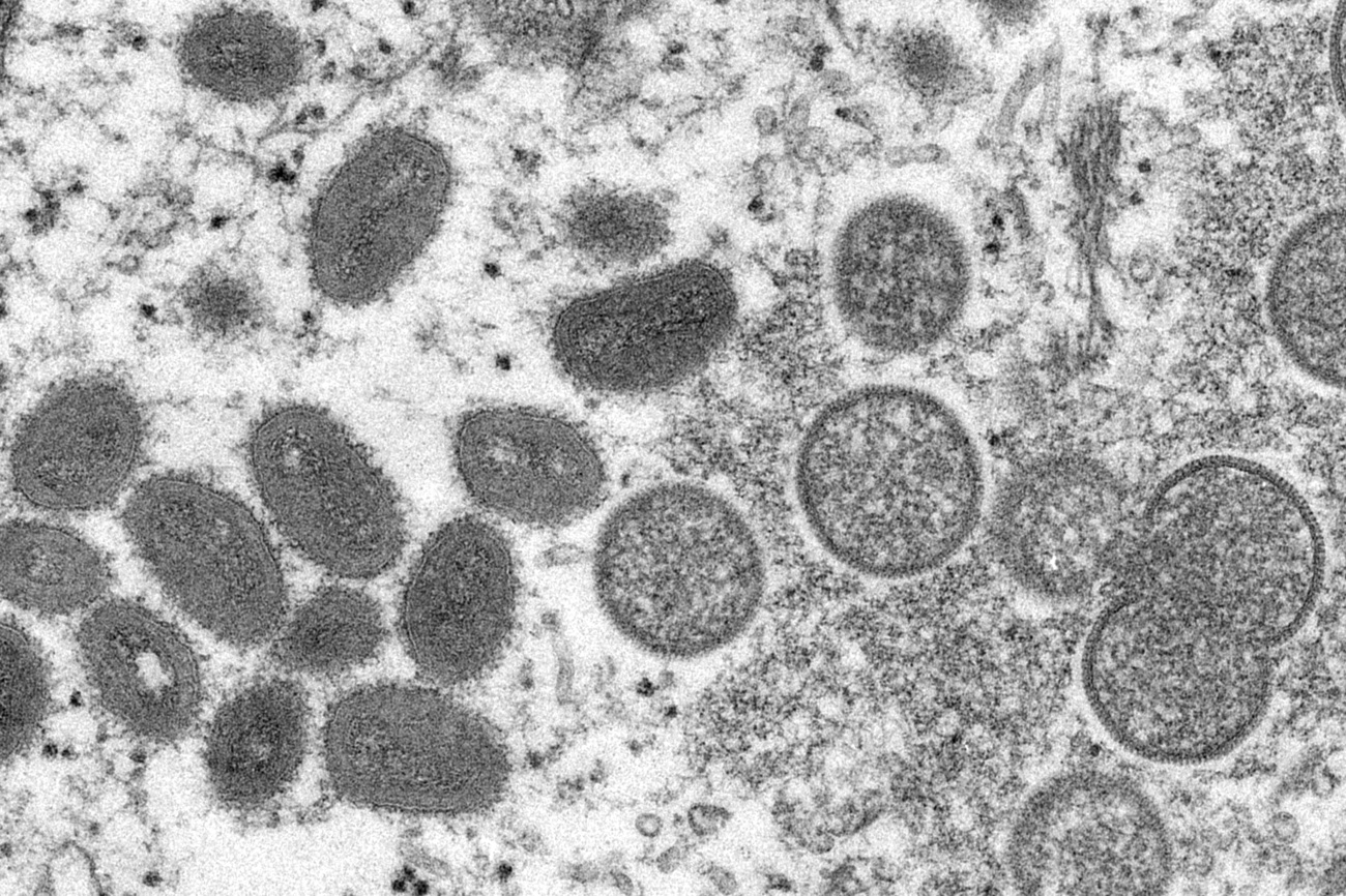 サル痘の電子顕微鏡写真