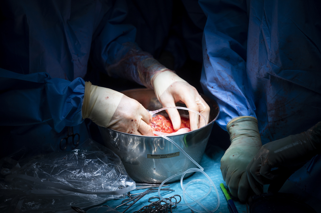 un organe en attente de transplantation