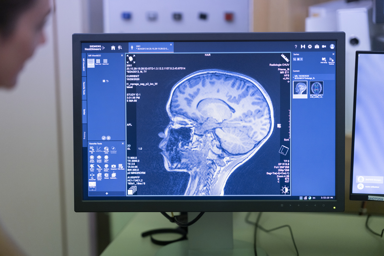 Una radiografia di un cranio.