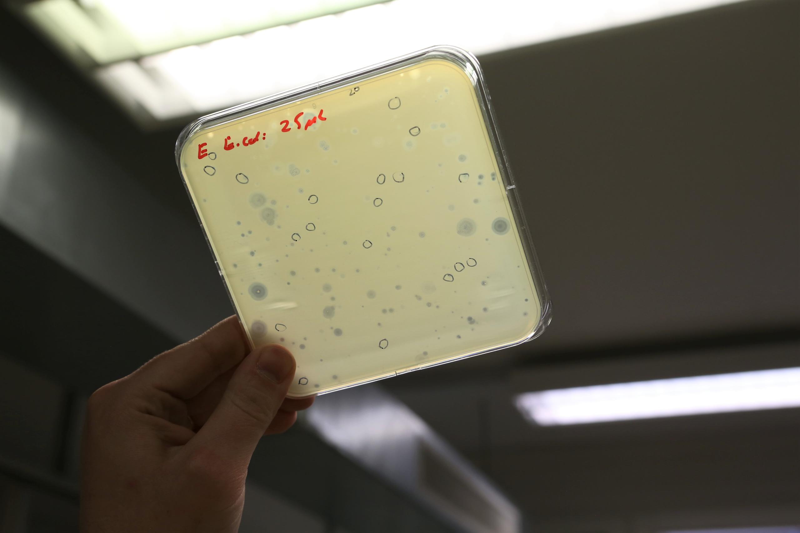 scatola petri con una coltura batterica