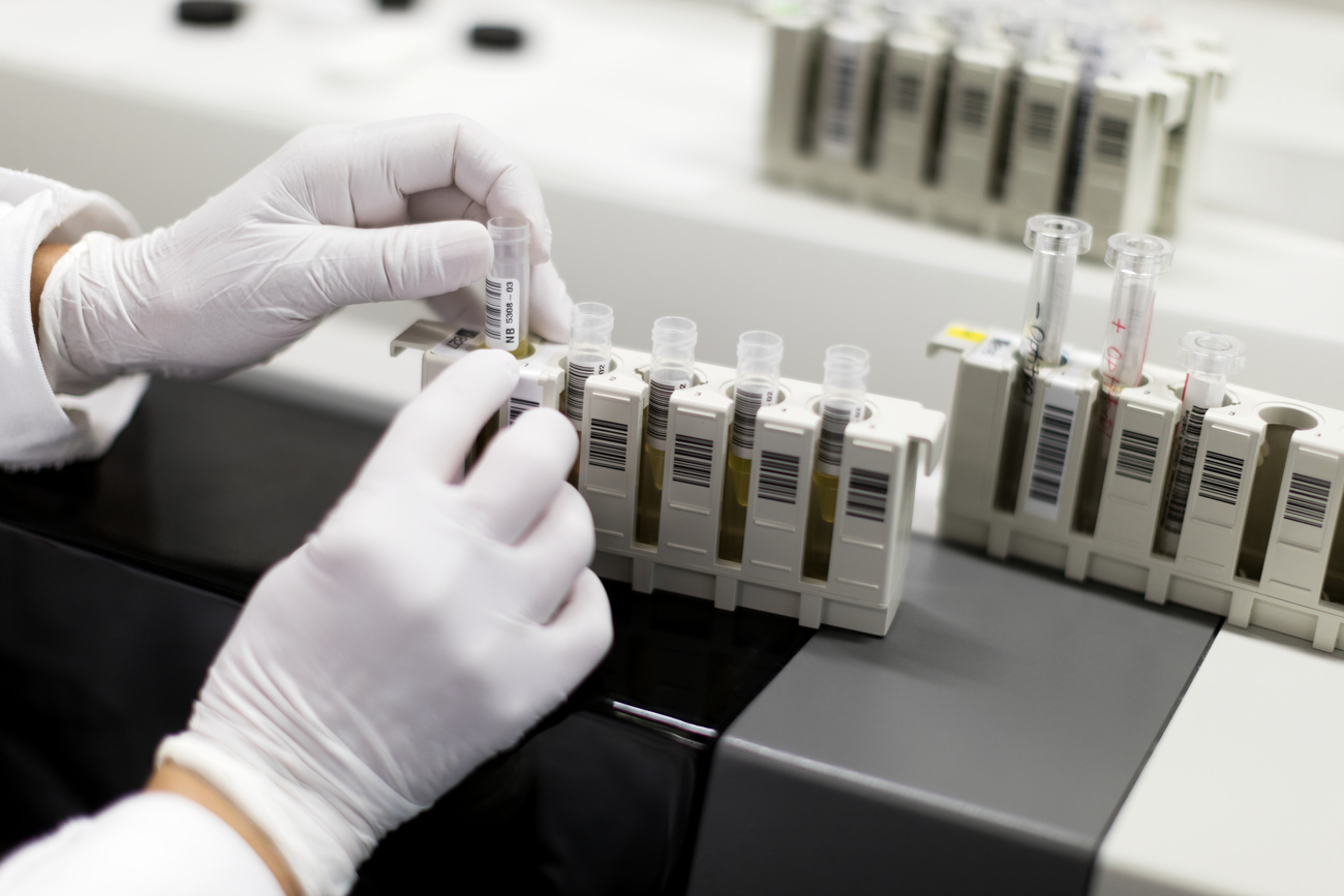 Blutuntersuchung im Rahmen eines HIV-Tests
