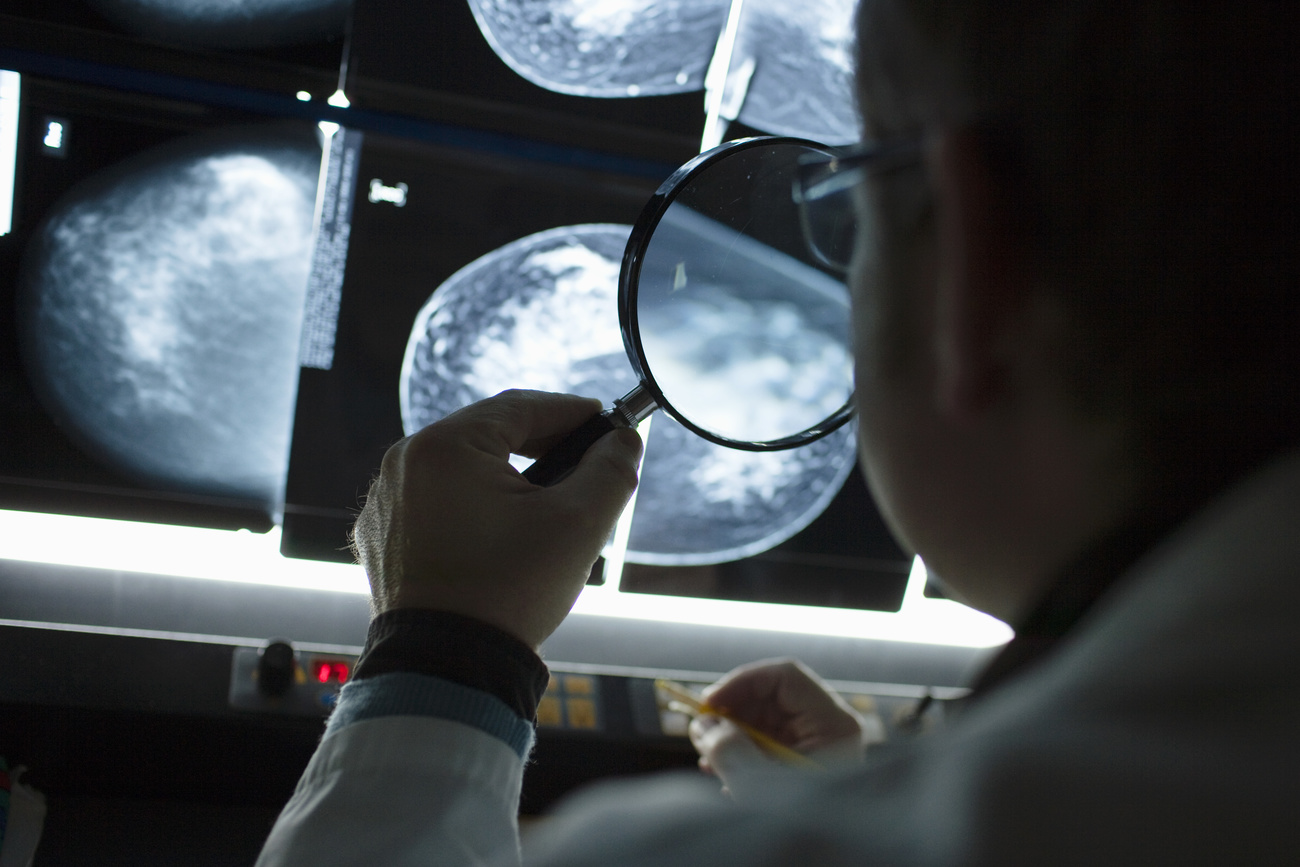 Mammogram