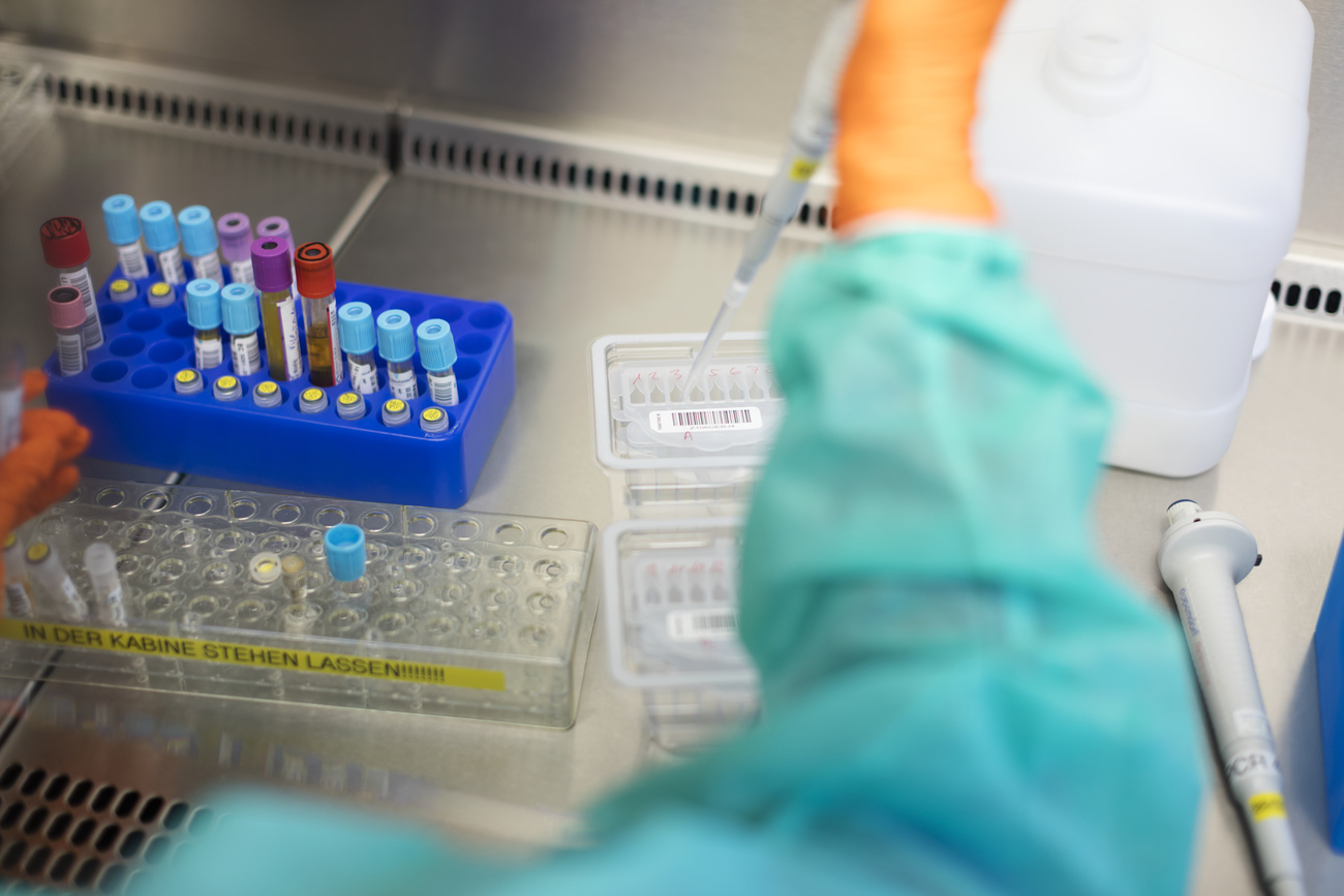 HIV testing vials in laboratory.