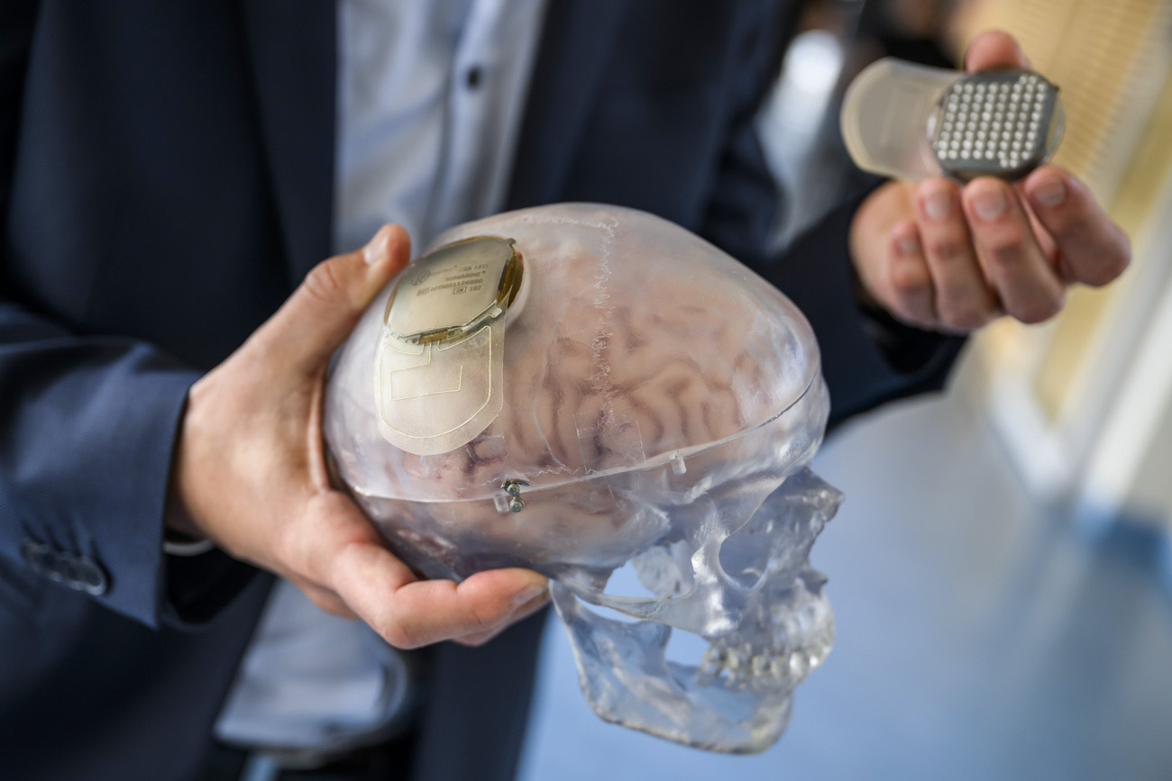 Brain implant.
