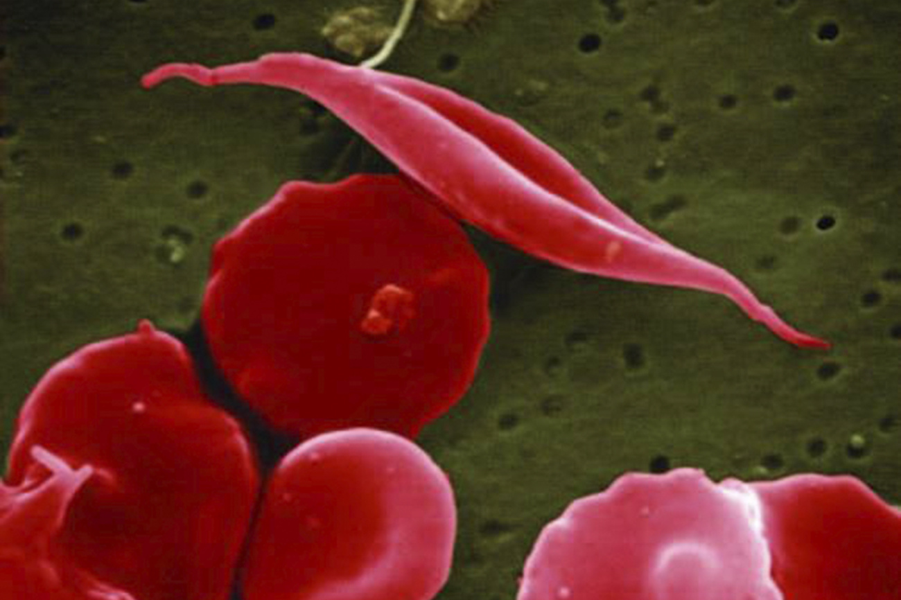 células vermelhas do sangue