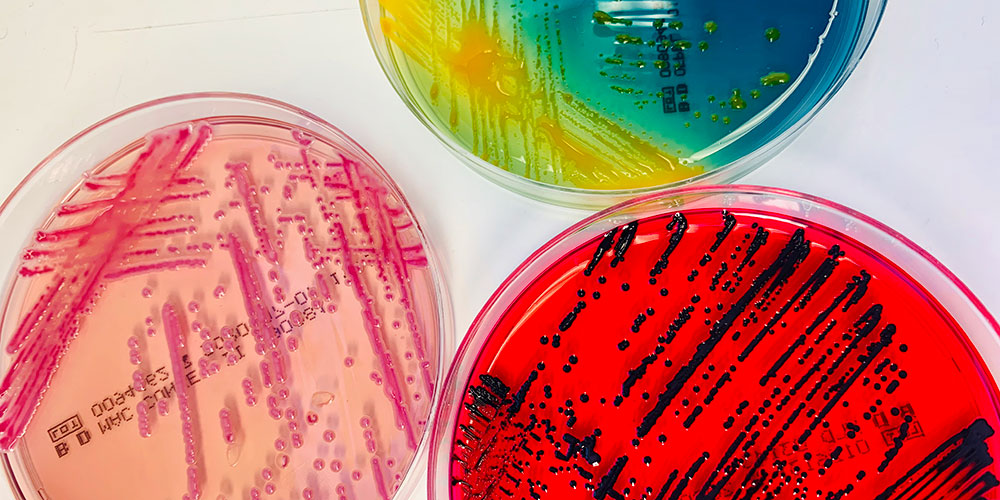 Bacteria cultures.