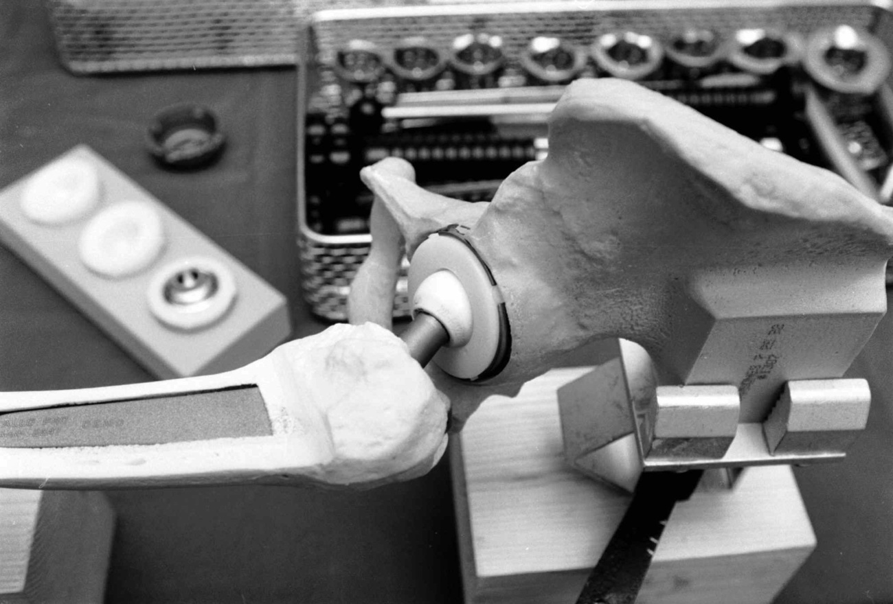 Ein kuenstliches Hueftgelenk: Das weltweit bekannteste Produkt des Unternehmens Sulzer Medica (Archivbild vom November 1993). Der Winterthurer Sulzer-Konzern will sein Medizinaltechnik-Unternehmen Sulzer Medica ab Mitte Juli 1997 an die Schweizer und an die New Yorker Boerse bringen, wie am 16. Juni 1997 bekannt wurde. Fuer den Boersengang werden 2,3 Millionen neue Aktien ausgegeben. Damit werden 24 Prozent des Aktienkapitals im Publikum plaziert. Den heutigen Aktionaeren der Sulzer AG wird dabei ein Vorwegzeichnungsrecht eingeraeumt. (KEYSTONE/Archive)