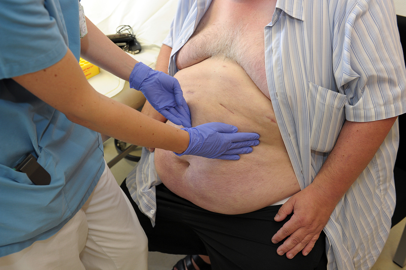 A patient with an overweight midsection is shown being handled by a gloved medical professional.