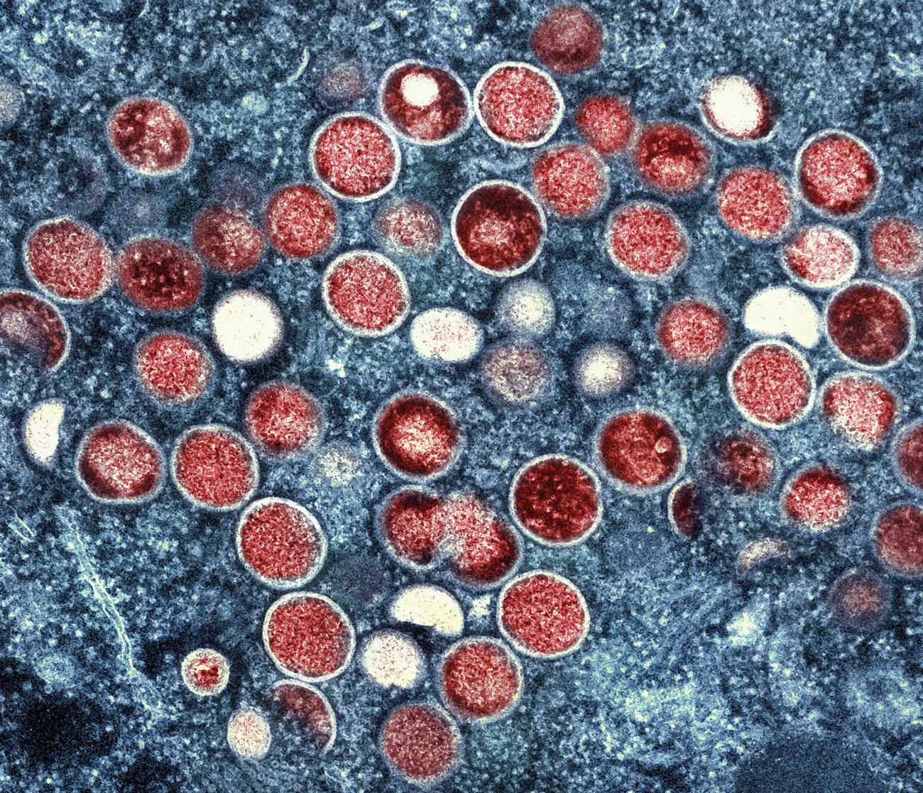 microscopic image of disease cells