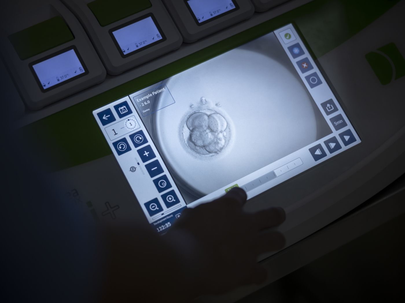 Egg donation should be allowed in Switzerland