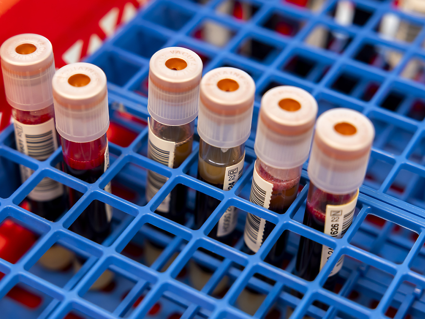 Demand for blood products to fall slightly in 2024