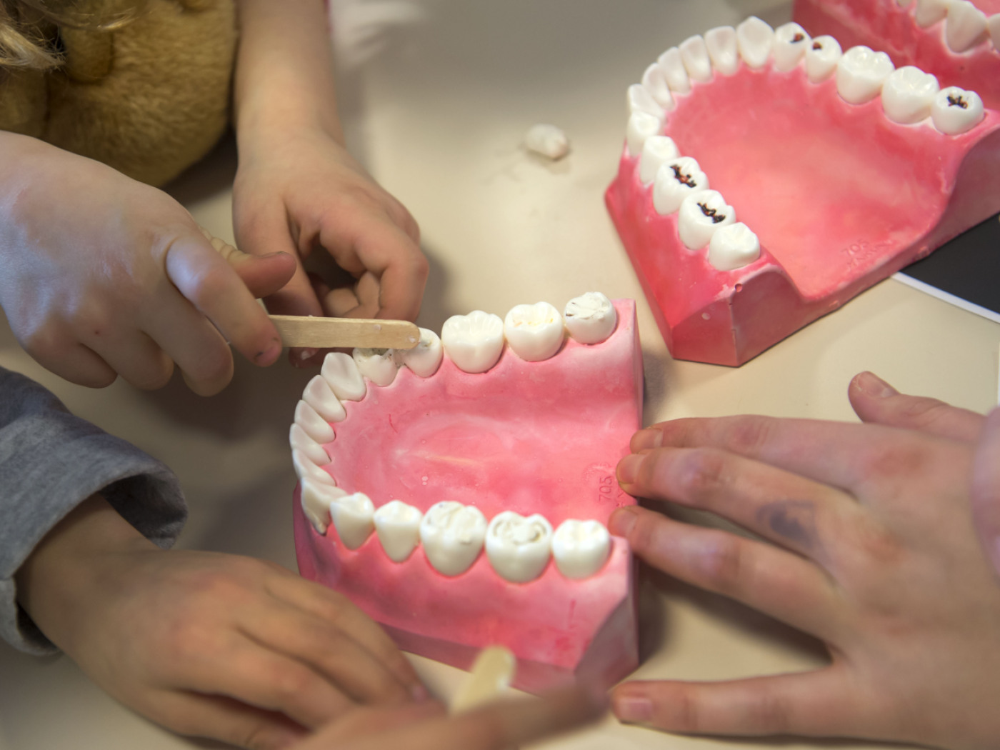 modelli di dentatura