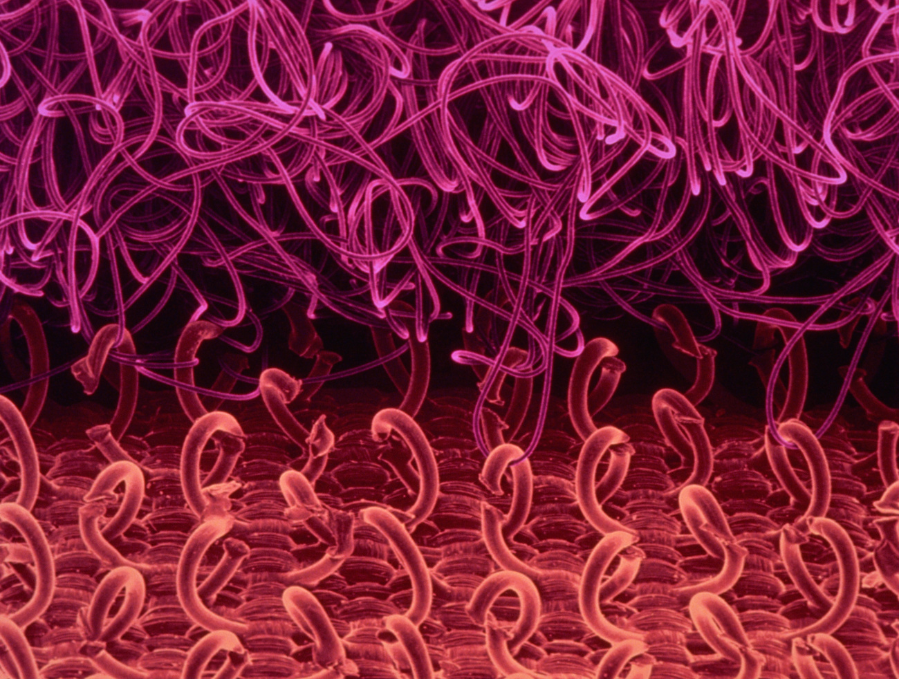 Velcro