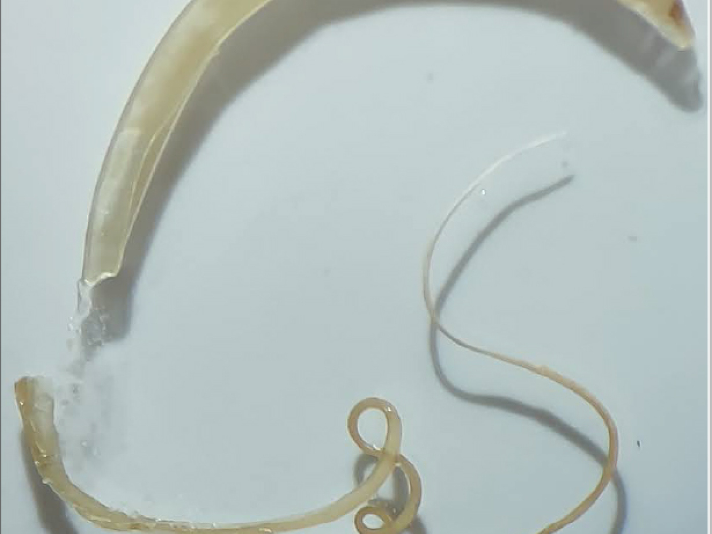 Research team from the Tropical Institute discovers new parasitic worm species