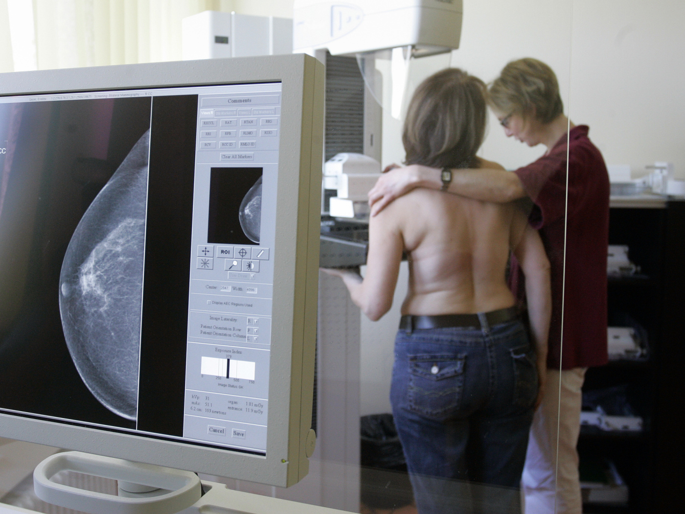 Roche claims clinical success against breast cancer